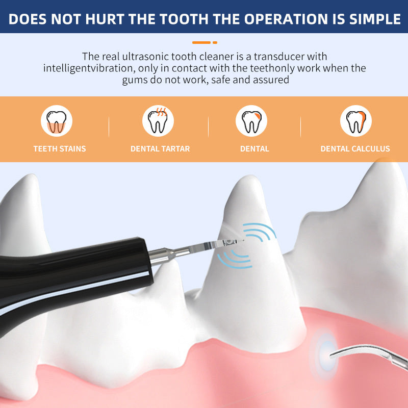 Ultrasonic Pet Teeth Cleaning Device – Dental Care for Dogs and Cats