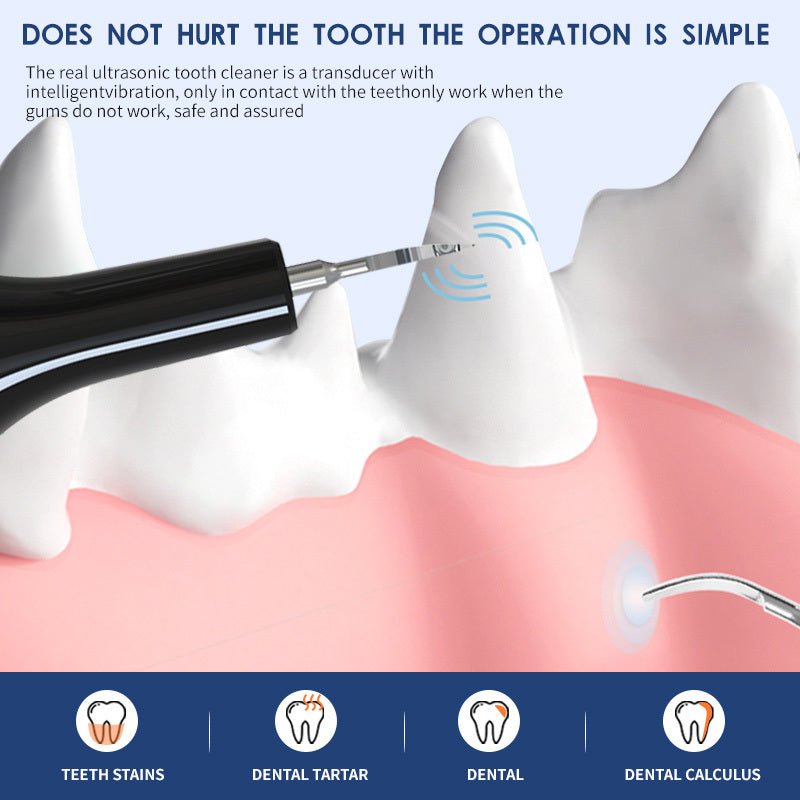 Ultrasonic Pet Teeth Cleaning Device – Dental Care for Dogs and Cats